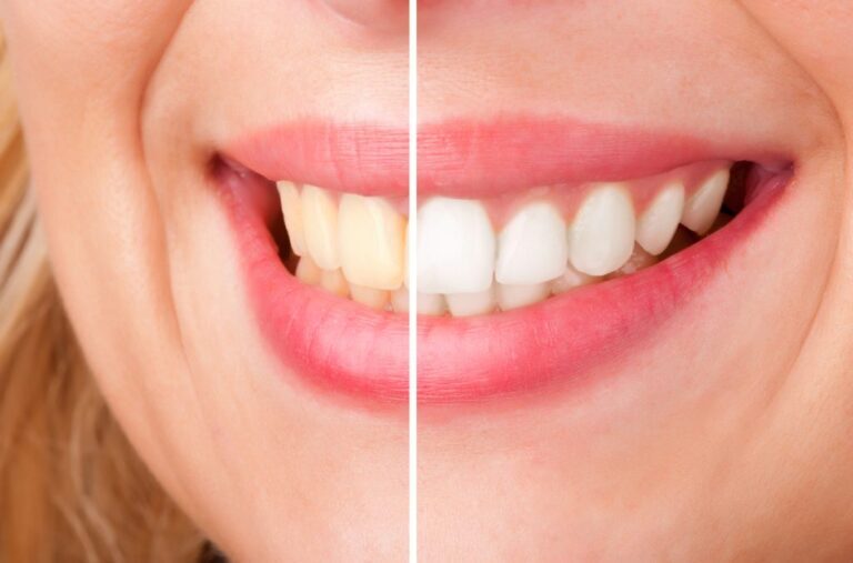 Seaway Family Dental - Cornwall Seaway Family Dental - Cornwall